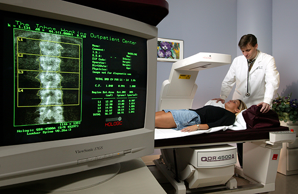 Measurement of bone density by DEXA scan